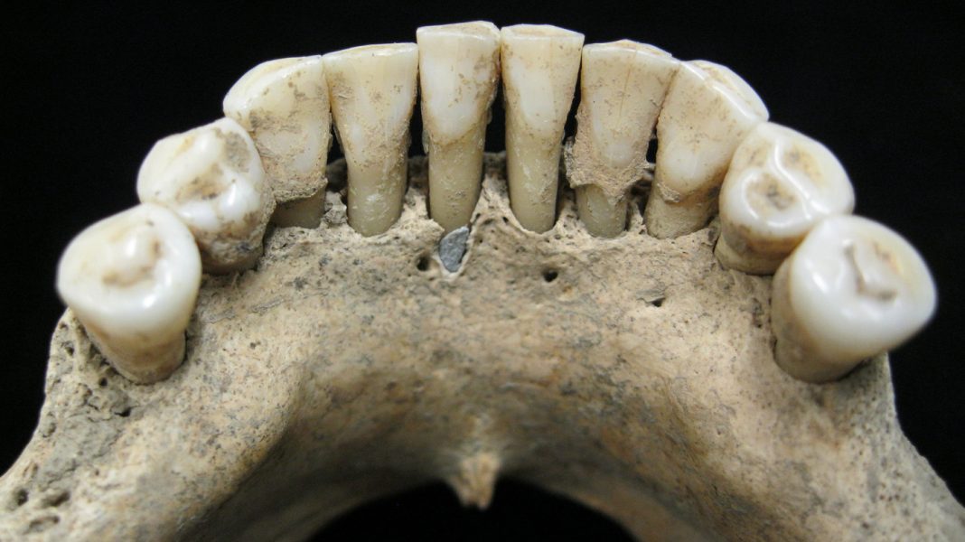 A Blue Hint In Middle Ages Teeth May Bespeak A Female’s Artistry Circa A.D. 1000